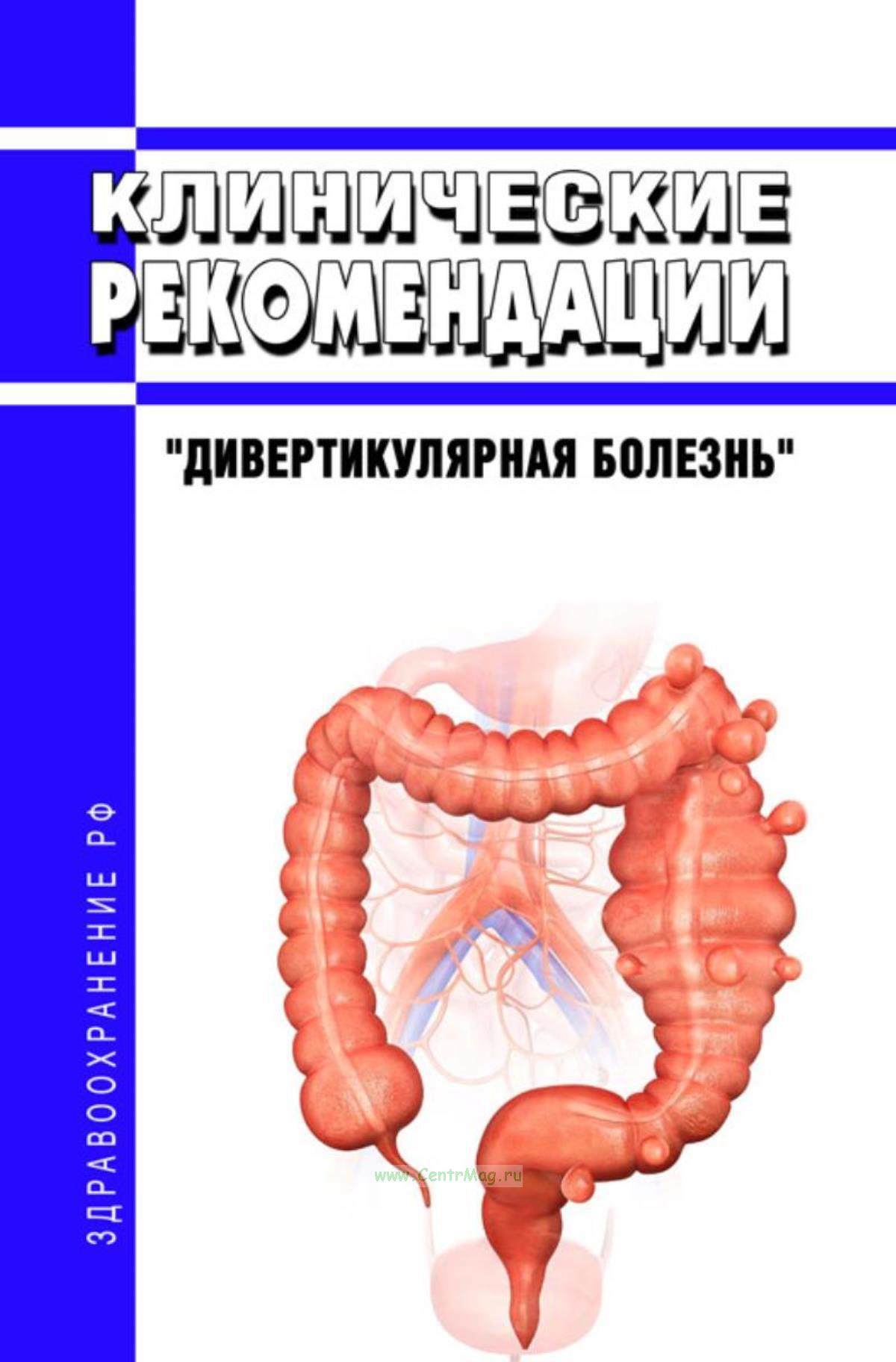 Дивертикулярная болезнь рекомендации